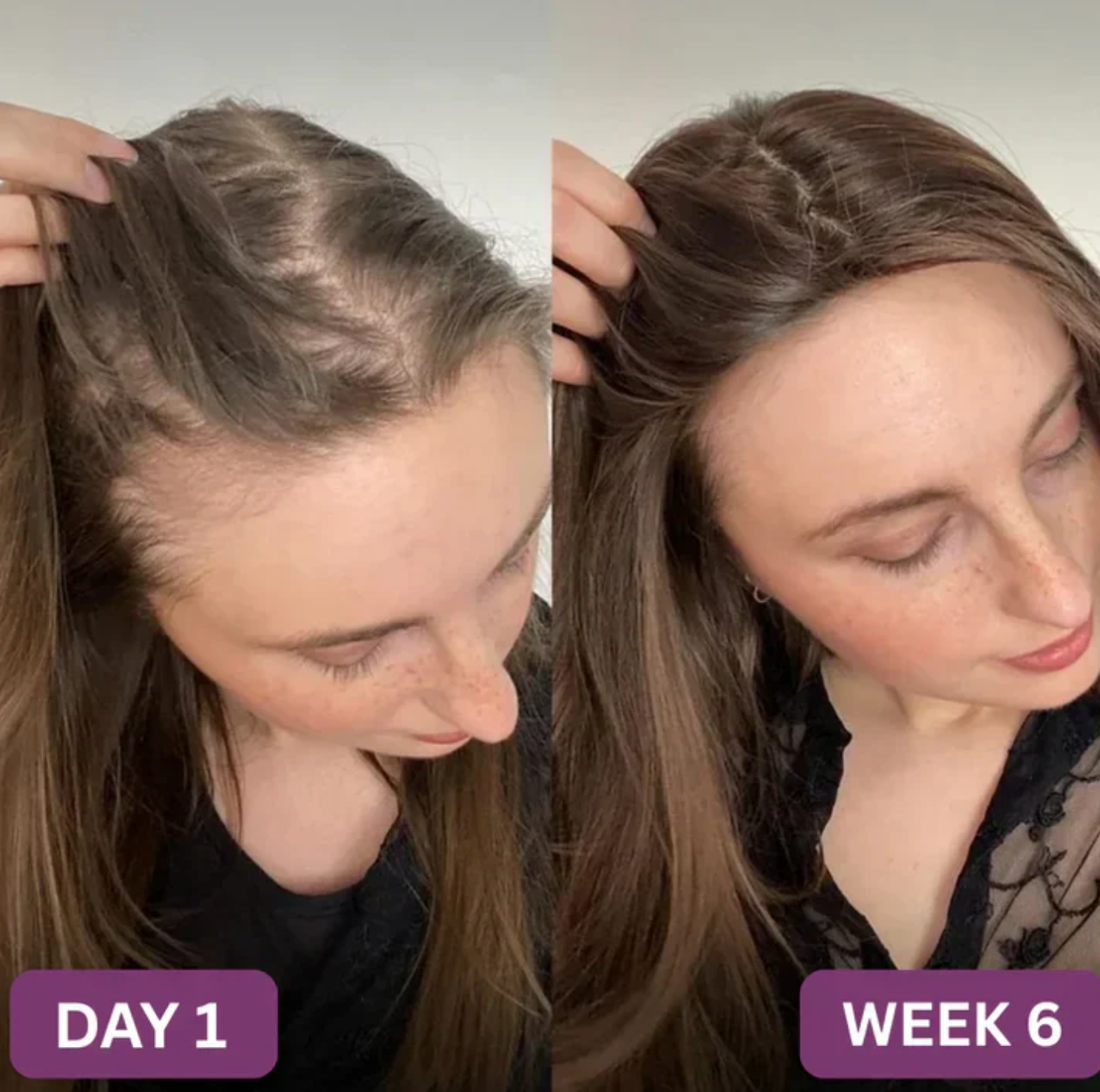 NaturBloom™ Hair Gummy