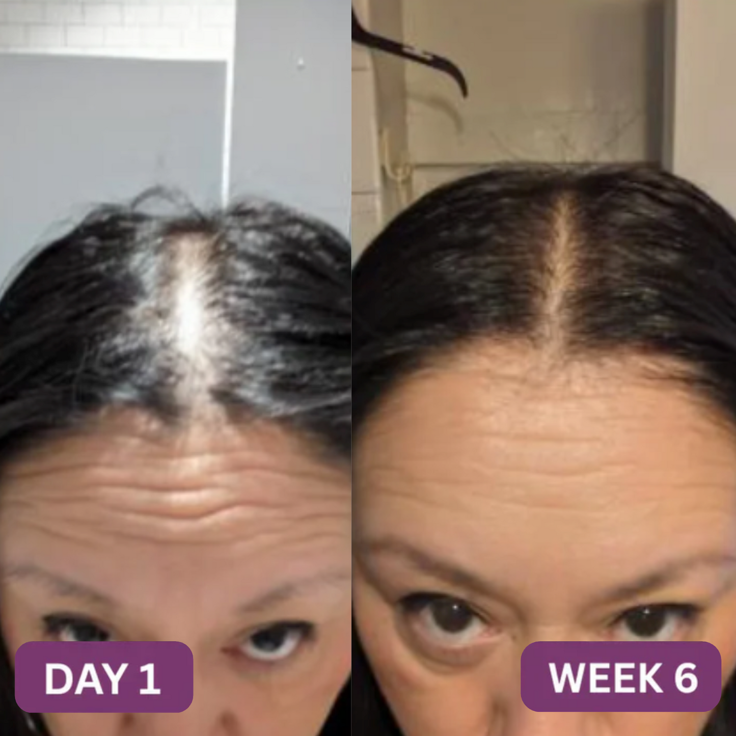 NaturBloom™ Hair Gummy